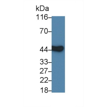 Interleukin 3 Receptor Alpha (IL3Ra) Mouse Polyclonal Antibody