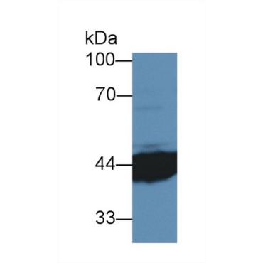Interleukin 3 Receptor Alpha (IL3Ra) Mouse Polyclonal Antibody