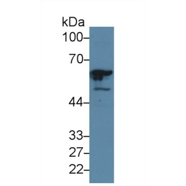 General Transcription Factor IIE, Polypeptide 1 (GTF2E1) Human Polyclonal Antibody