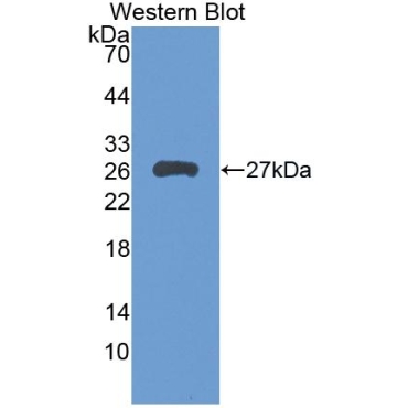 Leukocyte Immunoglobulin Like Receptor Subfamily B, Member 3 (LILRB3) Human Polyclonal Antibody