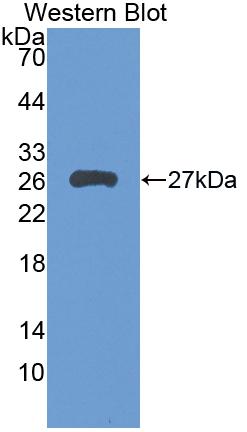 Leukocyte Immunoglobulin Like Receptor Subfamily B, Member 3 (LILRB3) Human Polyclonal Antibody