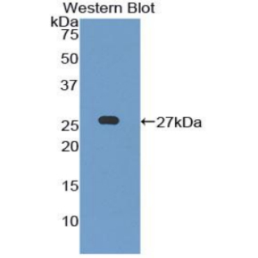 Leukocyte Immunoglobulin Like Receptor Subfamily B, Member 3 (LILRB3) Mouse Polyclonal Antibody