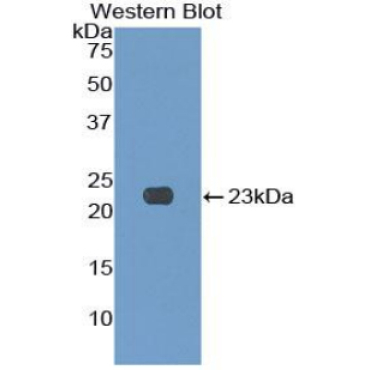 Killer Cell Lectin Like Receptor Subfamily C, Member 2 (KLRC2) Human Polyclonal Antibody