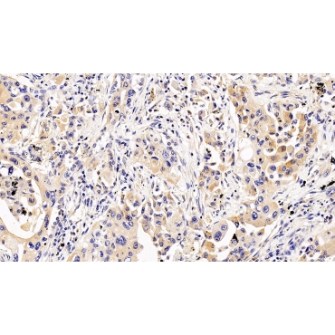 Interleukin 5 Receptor Alpha (IL5Ra) Human Polyclonal Antibody