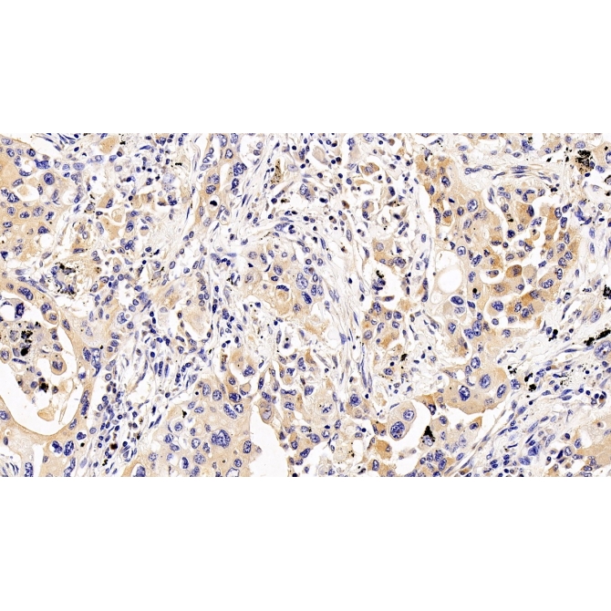 Interleukin 5 Receptor Alpha (IL5Ra) Human Polyclonal Antibody