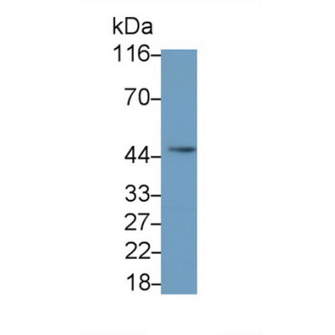 Interleukin 5 Receptor Alpha (IL5Ra) Mouse Polyclonal Antibody