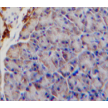 Interleukin 9 Receptor (IL9R) Mouse Polyclonal Antibody