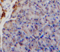 Interleukin 9 Receptor (IL9R) Mouse Polyclonal Antibody