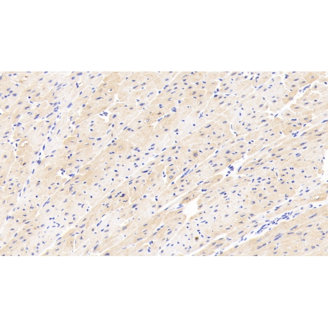 Cholinergic Receptor, Nicotinic, Beta 2 (CHRNb2) Human Polyclonal Antibody