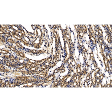 Interleukin 1 Receptor Associated Kinase 2 (IRAK2) Human Polyclonal Antibody