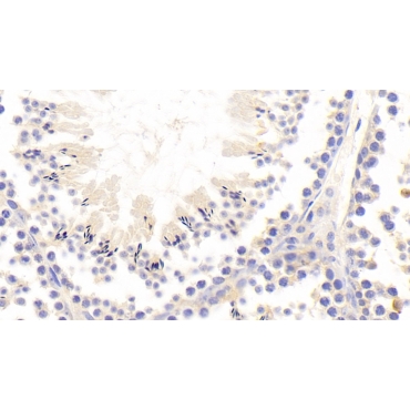 Interleukin 1 Receptor Associated Kinase 2 (IRAK2) Mouse Polyclonal Antibody