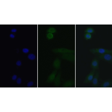 Interleukin 1 Receptor Associated Kinase 3 (IRAK3) Human Polyclonal Antibody