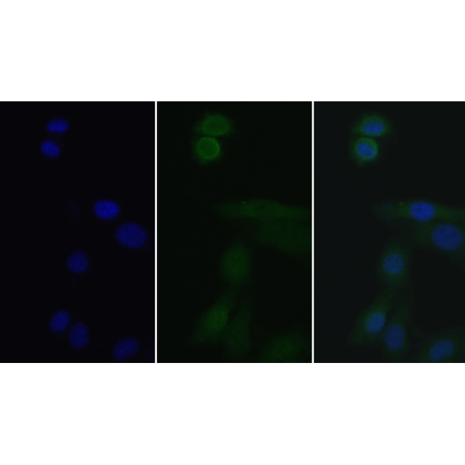 Interleukin 1 Receptor Associated Kinase 3 (IRAK3) Human Polyclonal Antibody