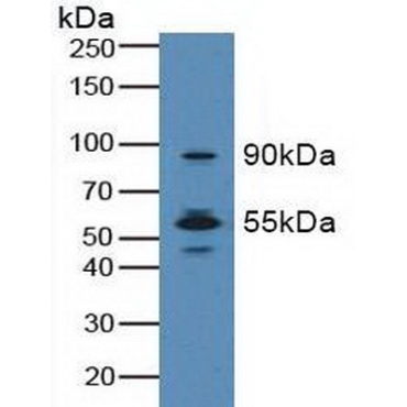 Macrophage Stimulating 1 Receptor (MST1R) Human Polyclonal Antibody