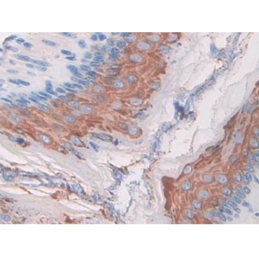 Macrophage Stimulating 1 Receptor (MST1R) Mouse Polyclonal Antibody