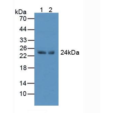 Tumor Necrosis Factor Receptor Superfamily, Member 9 (TNFRSF9) Human Polyclonal Antibody