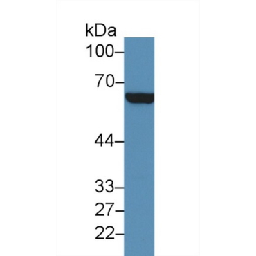 Cluster Of Differentiation 36 (CD36) Human Polyclonal Antibody
