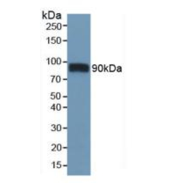 Cluster Of Differentiation 36 (CD36) Mouse Polyclonal Antibody