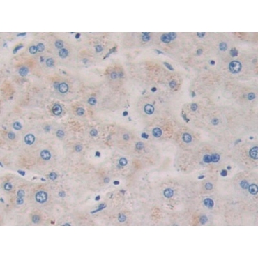 Probable ATP-dependent RNA Helicase DDX58 (DDX58) Human Polyclonal Antibody