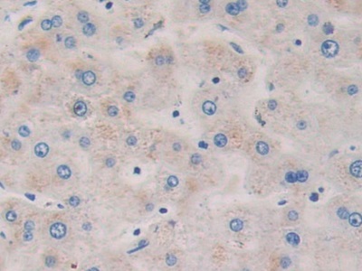 Probable ATP-dependent RNA Helicase DDX58 (DDX58) Human Polyclonal Antibody