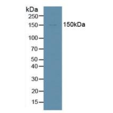 Probable ATP-dependent RNA Helicase DDX58 (DDX58) Mouse Polyclonal Antibody