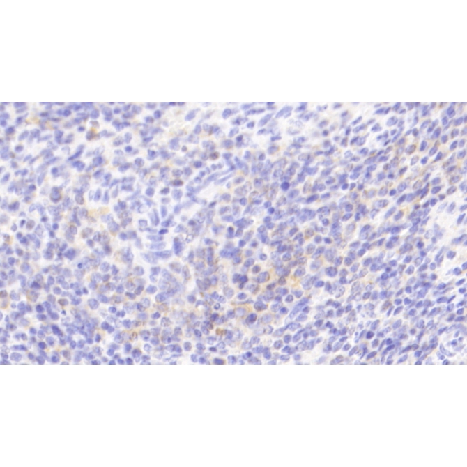 Chemokine C-C-Motif Receptor 1 (CCR1) Human Polyclonal Antibody