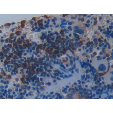 Protease, Serine 2 (PRSS2) Mouse Polyclonal Antibody