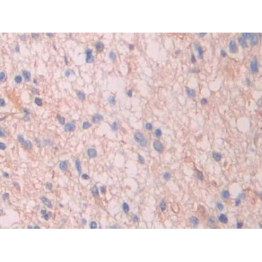 Serum Amyloid P Component (SAP) Human Polyclonal Antibody