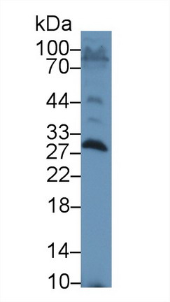 Serum Amyloid P Component (SAP) Rat Polyclonal Antibody
