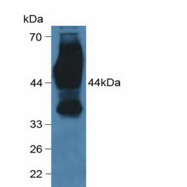 Cluster Of Differentiation 147 (CD147) Human Polyclonal Antibody