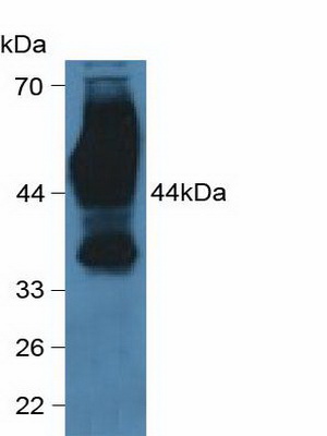 Cluster Of Differentiation 147 (CD147) Human Polyclonal Antibody