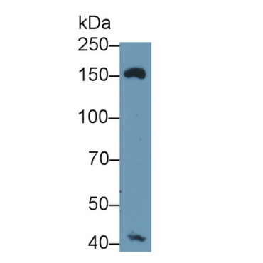 Mannose Receptor C Type 1 (MRC1) Human Polyclonal Antibody