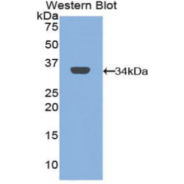 Mannose Receptor C Type 1 (MRC1) Mouse Polyclonal Antibody