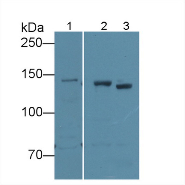 Density Enhanced Phosphatase 1 (DEP1) Human Polyclonal Antibody