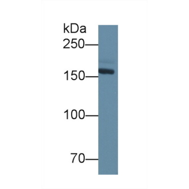 Density Enhanced Phosphatase 1 (DEP1) Mouse Polyclonal Antibody
