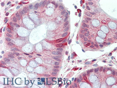 Density Enhanced Phosphatase 1 (DEP1) Rat Polyclonal Antibody