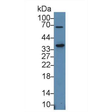 Signaling Lymphocytic Activation Molecule Family, Member 1 (SLAMF1) Human Polyclonal Antibody