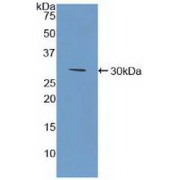 Bone Marrow Stromal Cell Antigen 1 (BST1) Human Polyclonal Antibody
