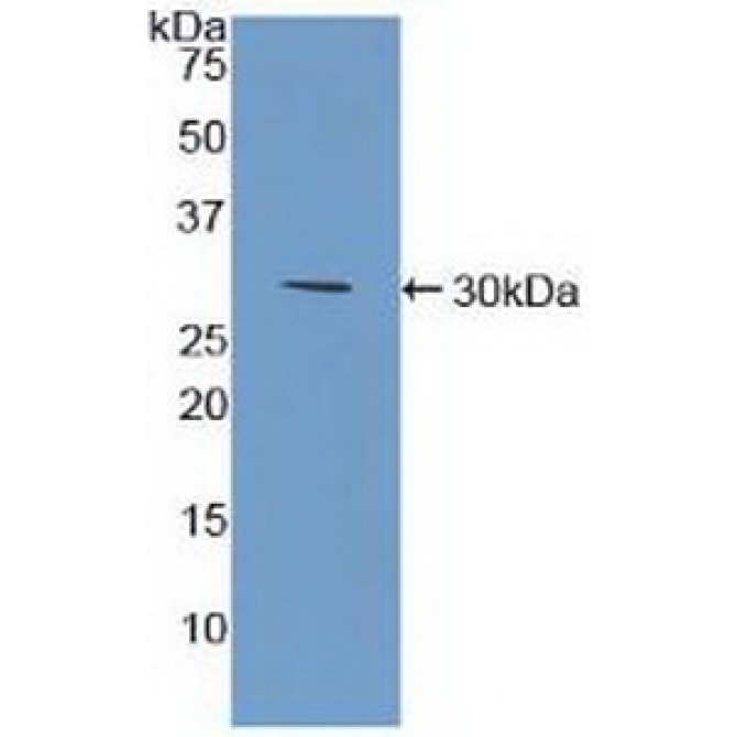 Bone Marrow Stromal Cell Antigen 1 (BST1) Human Polyclonal Antibody