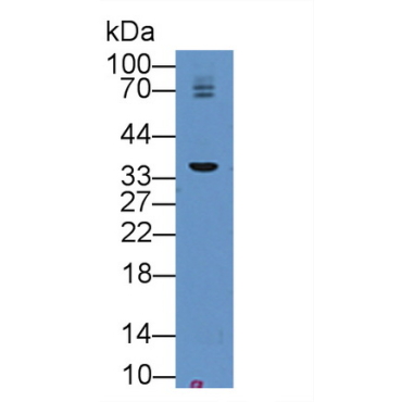 Bone Marrow Stromal Cell Antigen 1 (BST1) Mouse Polyclonal Antibody