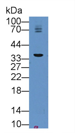 Bone Marrow Stromal Cell Antigen 1 (BST1) Mouse Polyclonal Antibody