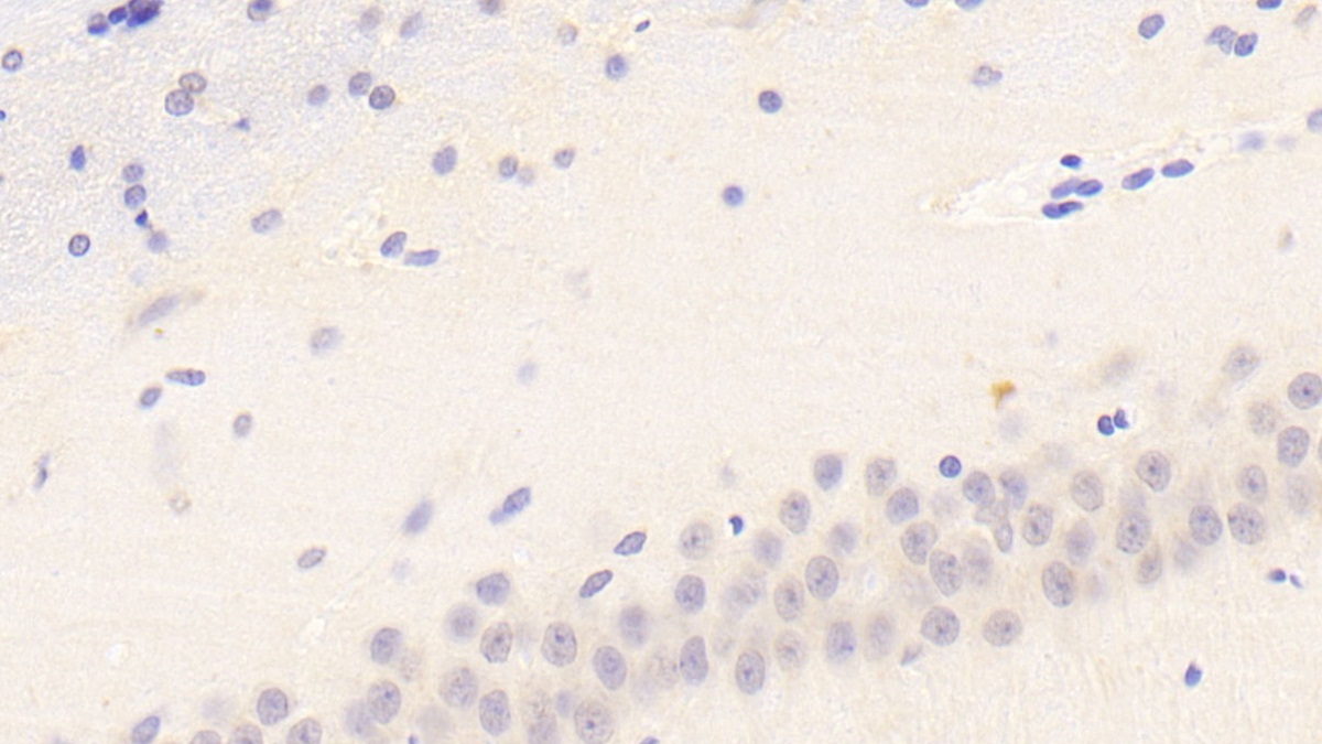 Bone Marrow Stromal Cell Antigen 1 (BST1) Rat Polyclonal Antibody