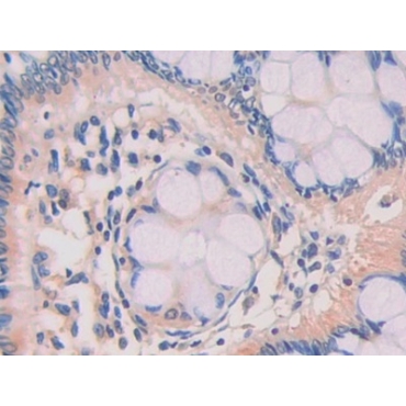 Z-DNA Binding Protein 1 (ZBP1) Human Polyclonal Antibody