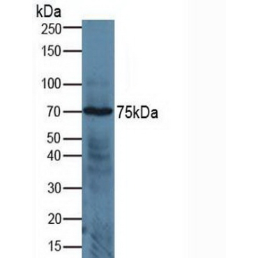 A Disintegrin And Metalloprotease 17 (ADAM17) Human Polyclonal Antibody