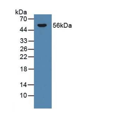 Cytochrome P450 Family 21 Subfamily A Member 2 (CYP21A2) Human Polyclonal Antibody