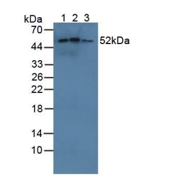 Cytochrome P450 Family 21 Subfamily A Member 2 (CYP21A2) Mouse Polyclonal Antibody