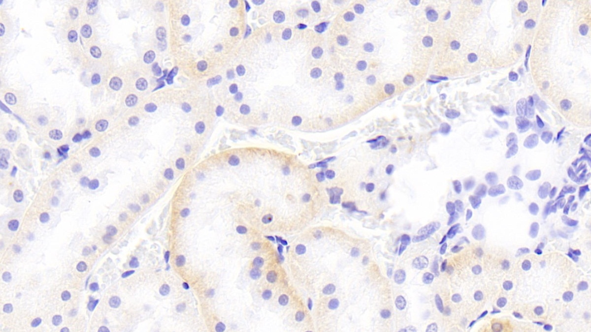 Cytochrome P450 Family 21 Subfamily A Member 2 (CYP21A2) Rat Polyclonal Antibody