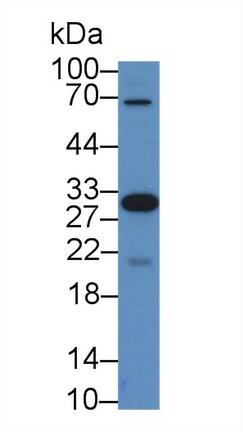 Killer Cell Immunoglobulin Like Receptor 2DS4 (KIR2DS4) Human Polyclonal Antibody