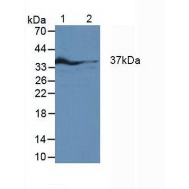 Interferon Regulatory Factor 1 (IRF1) Human Polyclonal Antibody