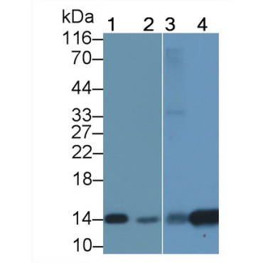Fatty Acid Binding Protein 1 (FABP1) Human Polyclonal Antibody